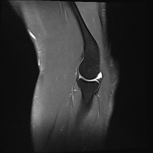 Click on the Serie image to view the images of Wieszt, Gnter